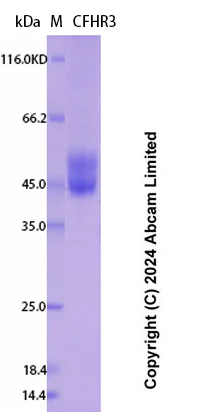 SDS-PAGE - Recombinant Human CFHR3 Protein Standard (His tag) (AB323094)