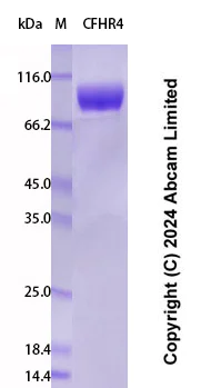 SDS-PAGE - Recombinant Human CFHR4 Protein Standard (His tag) (AB323045)