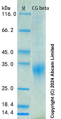 SDS-PAGE - Recombinant Human CG beta Protein Standard (His tag) (AB322752)