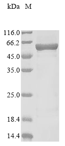 SDS-PAGE - Recombinant Human cGAS protein (AB289781), expandable thumbnail