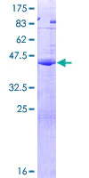SDS-PAGE - Recombinant Human CGB5 protein (AB164948)