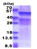 SDS-PAGE - Recombinant Human CGT protein (denatured) (His tag N-Terminus) (AB176082)