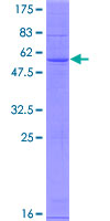 Recombinant Human CH25H protein