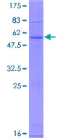 SDS-PAGE - Recombinant Human CH25H protein (AB160295)