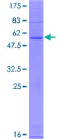 SDS-PAGE - Recombinant Human CH25H protein (GST tag N-Terminus) (AB160295)