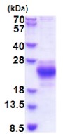 SDS-PAGE - Recombinant Human CHAC2 protein (AB177655)
