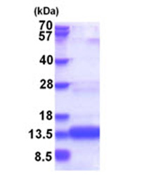 SDS-PAGE - Recombinant Human CHCHD8 protein (AB181921), expandable thumbnail