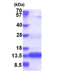 SDS-PAGE - Recombinant Human CHCHD8 protein (AB181921)
