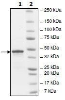 SDS-PAGE - Recombinant Human CHD2 protein (AB198642)