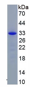 SDS-PAGE - Recombinant Human CHD4 protein (His tag) (AB275792), expandable thumbnail