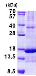 SDS-PAGE - Recombinant Human Chemerin protein (denatured) (AB156357), expandable thumbnail