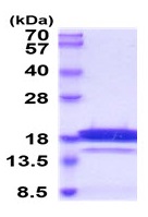 SDS-PAGE - Recombinant Human Chemerin protein (His tag) (AB224790), expandable thumbnail