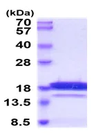 SDS-PAGE - Recombinant Human Chemerin protein (His tag) (AB224790)