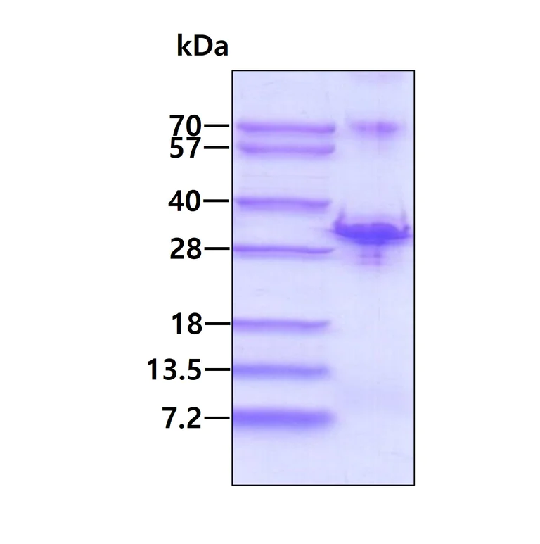 SDS-PAGE - Recombinant Human CHMP1a protein (His tag N-Terminus) (AB139206)