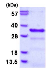 SDS-PAGE - Recombinant Human CHMP1B protein (His tag N-Terminus) (AB126679)