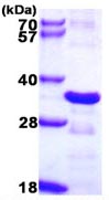 SDS-PAGE - Recombinant Human CHMP2B protein (AB109959), expandable thumbnail