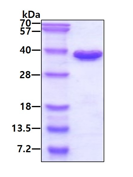 SDS-PAGE - Recombinant Human CHMP6/VPS20 protein (His tag N-Terminus) (AB124606)