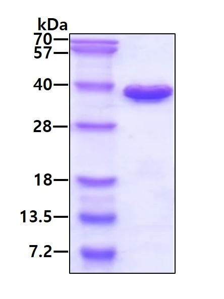 SDS-PAGE - Recombinant Human CHMP6/VPS20 protein (His tag N-Terminus) (AB124606)