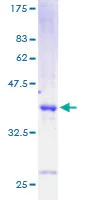 SDS-PAGE - Recombinant Human Cholecystokinin protein (AB158040)