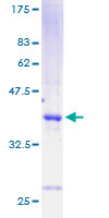 SDS-PAGE - Recombinant Human Cholecystokinin protein (GST tag N-Terminus) (AB158040)