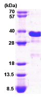 SDS-PAGE - Recombinant Human CHOP protein (His tag N-Terminus) (AB74521)
