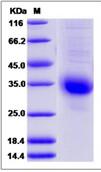 SDS-PAGE - Recombinant Human Choriogonadotropin subunit beta 3 protein (His tag) (AB276623), expandable thumbnail