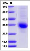SDS-PAGE - Recombinant Human Choriogonadotropin subunit beta 3 protein (His tag) (AB276623)