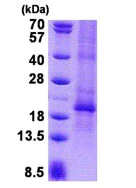 SDS-PAGE - Recombinant Human Chorionic Gonadotropin protein (denatured) (His tag N-Terminus) (AB140723)