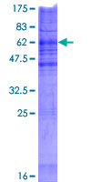 Recombinant Human CHPT1/CPT1 protein