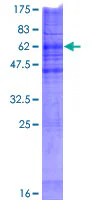 SDS-PAGE - Recombinant Human CHPT1/CPT1 protein (GST tag N-Terminus) (AB163457)