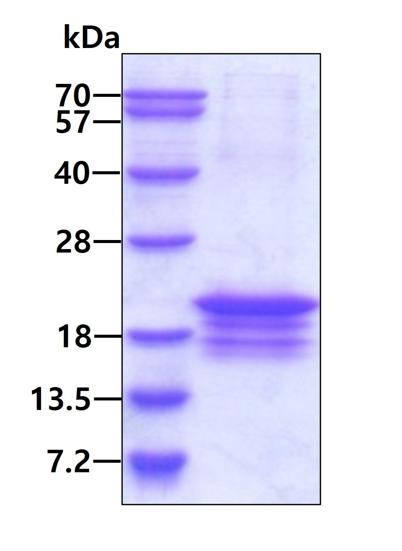 SDS-PAGE - Recombinant Human CHRAC-17 protein (His tag) (AB156724)