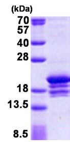 SDS-PAGE - Recombinant Human CHRAC-17 protein (His tag N-Terminus) (AB156724)