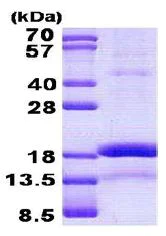 SDS-PAGE - Recombinant Human CHRAC1 protein (denatured) (His tag N-Terminus) (AB140575)