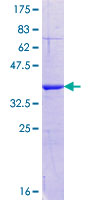 SDS-PAGE - Recombinant Human CHREBP protein (GST tag N-Terminus) (AB162408)
