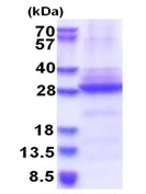 SDS-PAGE - Recombinant Human CHRNA6 protein (denatured) (His tag N-Terminus) (AB177721)