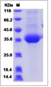 SDS-PAGE - Recombinant Human CHRNB3 protein (His tag) (AB276651)