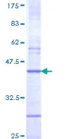 SDS-PAGE - Recombinant Human CHRNB4 protein (AB158120)