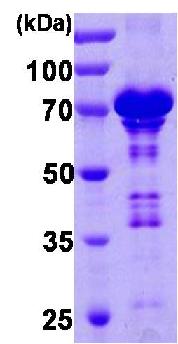 SDS-PAGE - Recombinant Human Chromogranin A protein (AB85486), expandable thumbnail