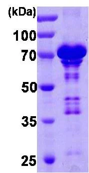 SDS-PAGE - Recombinant Human Chromogranin A protein (AB85486)