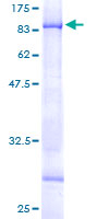 Recombinant Human CHST15 protein