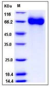 SDS-PAGE - Recombinant Human CHST15 protein (His tag) (AB276354)