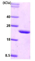 SDS-PAGE - Recombinant Human CIB1/KIP protein (AB78759)