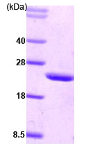 SDS-PAGE - Recombinant Human CIB1/KIP protein (His tag N-Terminus) (AB78759)