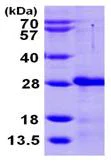 SDS-PAGE - Recombinant Human CIB2 protein (AB104126)