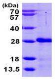 SDS-PAGE - Recombinant Human CIB2 protein (His tag N-Terminus) (AB104126)