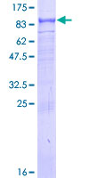 SDS-PAGE - Recombinant Human CIKS/ACT1 protein (AB161141), expandable thumbnail