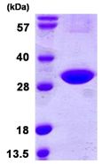 SDS-PAGE - Recombinant Human CINP protein (AB109973), expandable thumbnail