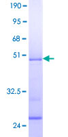 Recombinant Human CIRP protein