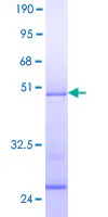 SDS-PAGE - Recombinant Human CIRP protein (GST tag N-Terminus) (AB116730)