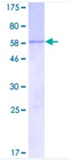 SDS-PAGE - Recombinant Human CISH/CIS protein (AB117057), expandable thumbnail